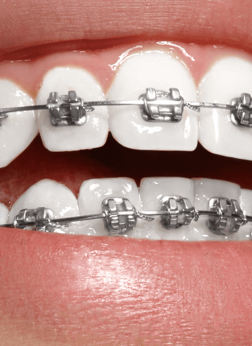 ortodonti