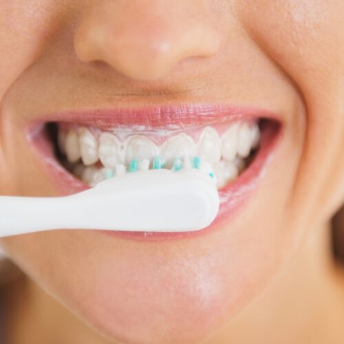 Genel arşivleri Sayfa 3 / 4 Dentomega