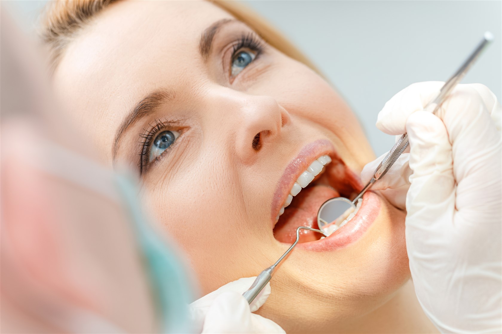 Diş Hekimi Rutin Kontrolünde Neler Yapılır?
