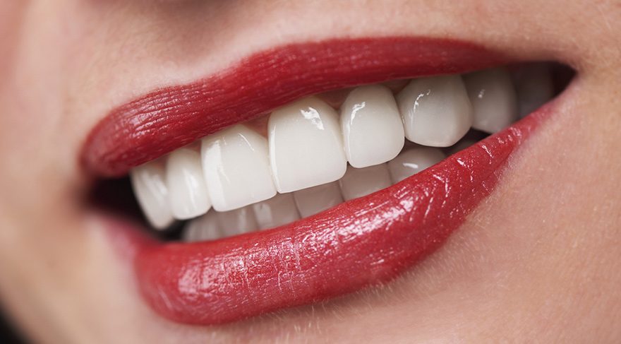 Diş Beyazlatma Uzun Süre Etkili Mi?