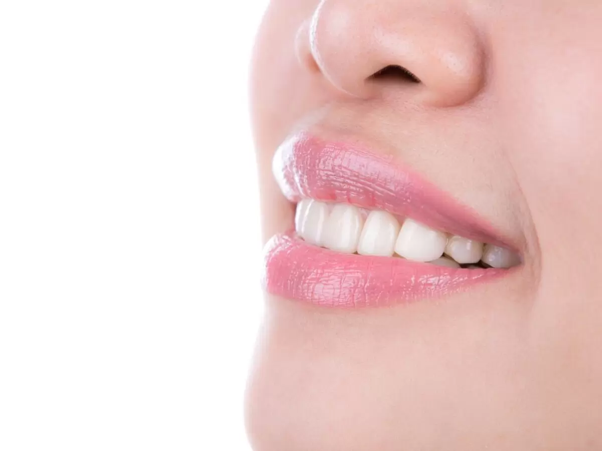 Diş Beyazlatma İşleminde Renk Kaç Ton Açılır?