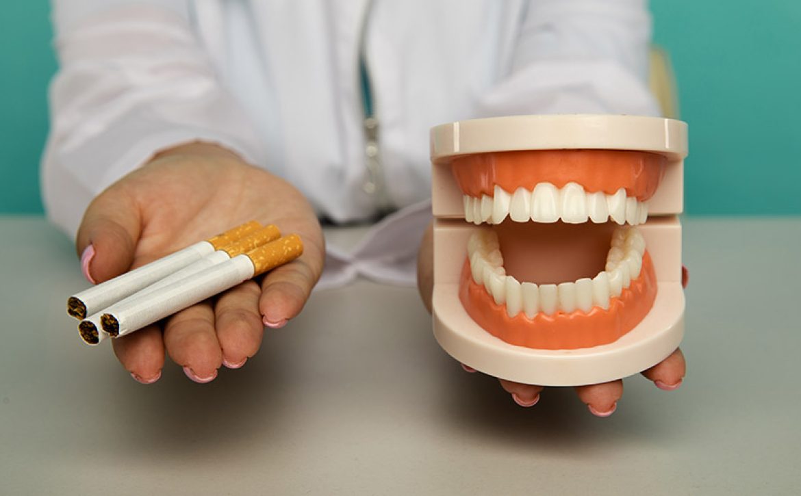 Sigaranın Diş Sağlığına Etkileri Nelerdir?