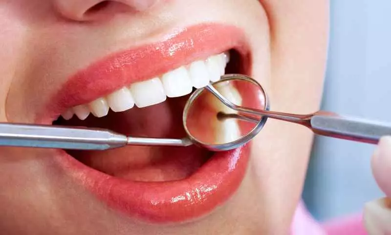 Eklem Plağı Nedir? Ne Kadar Sürede Bir Diş Hekimi Kontrolüne Gidilmesi Gerekir?