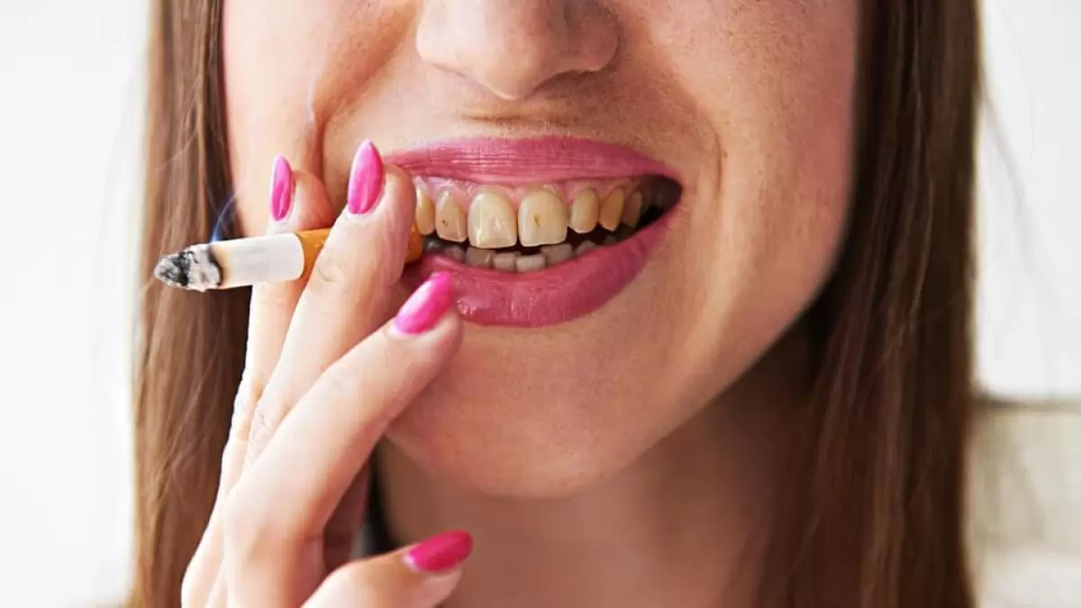 Sigara Kullanmanın Ağız ve Diş Sağlığına Etkileri Nelerdir?