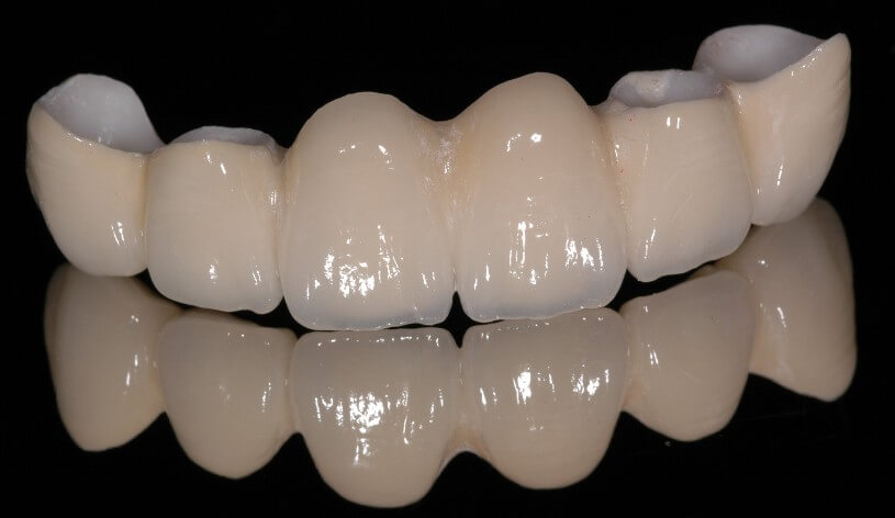 Zirkonyum Diş Nasıl Anlaşılır?