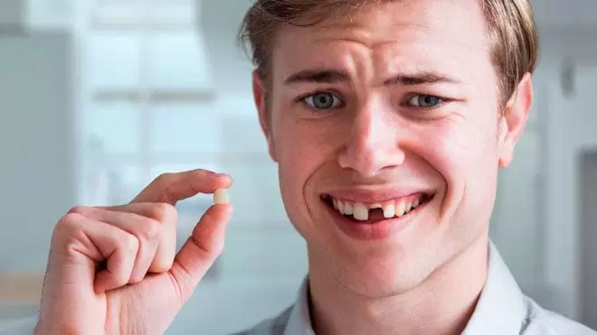 Diş Kökü Erir Mi? Neden Erir?