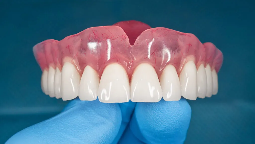 Diş Etindeki Mor Renklenmelerin Sebepleri ve Tedavisi