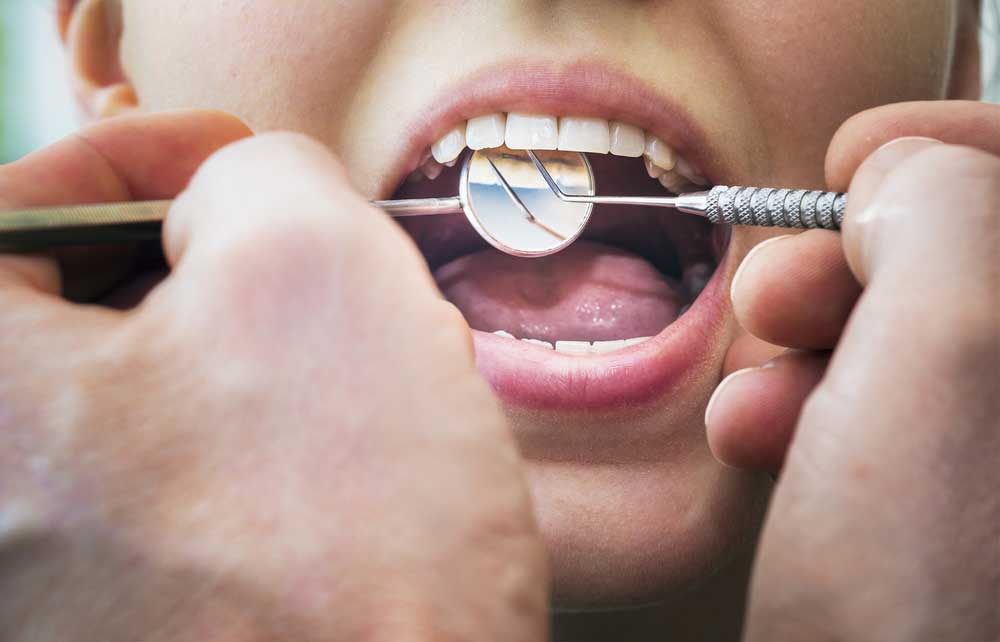 Ön Diş Çürüğü Tedavisi Nasıl Yapılır?