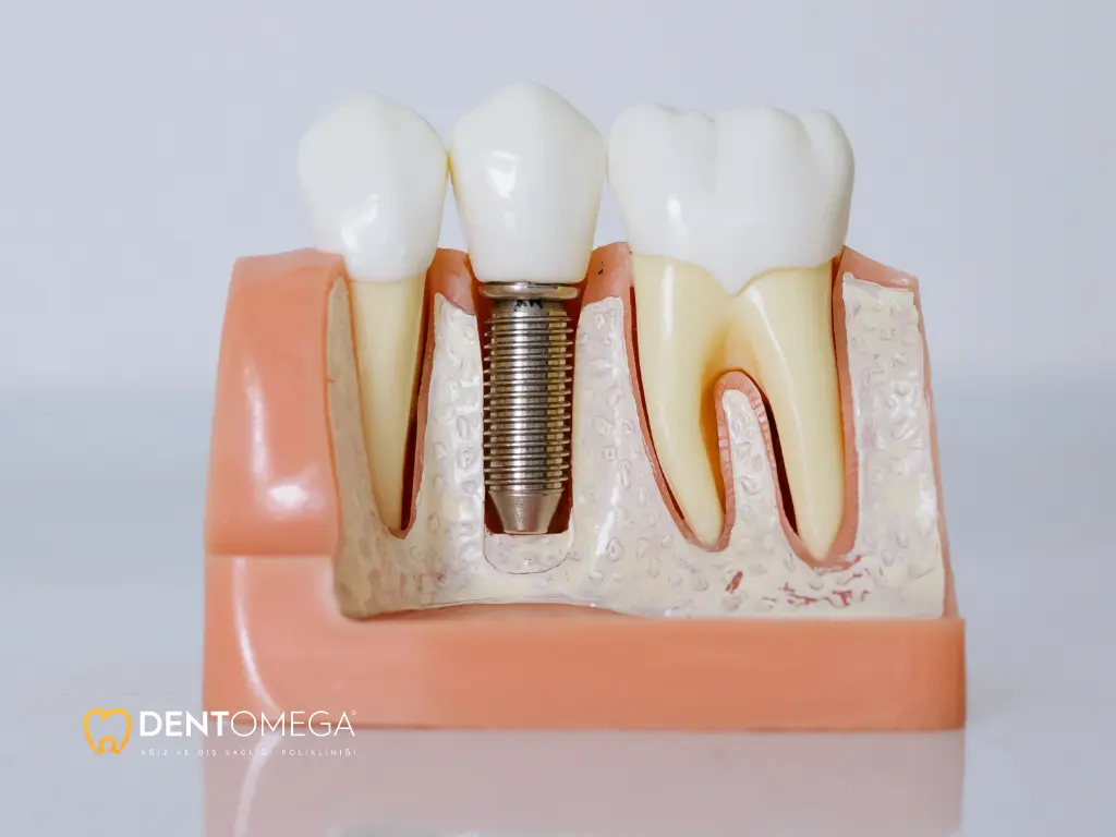 kalp-hastalari-implant