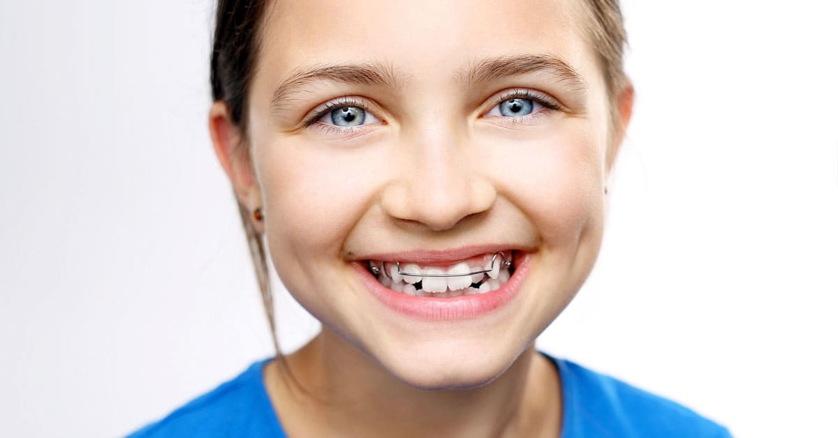 Çocuklarda İlk Ortodontik Kontrol Ne Zaman Yapılmalıdır?