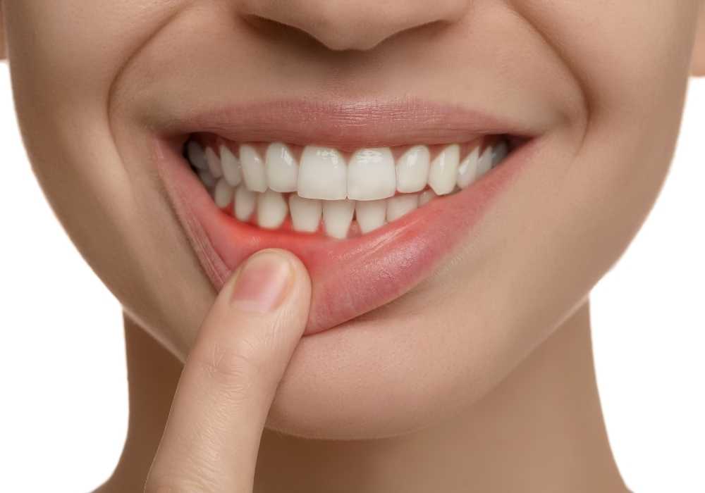 Diş Eti Hastalığı ve Tansiyon Hastalığı Arasındaki İlişki