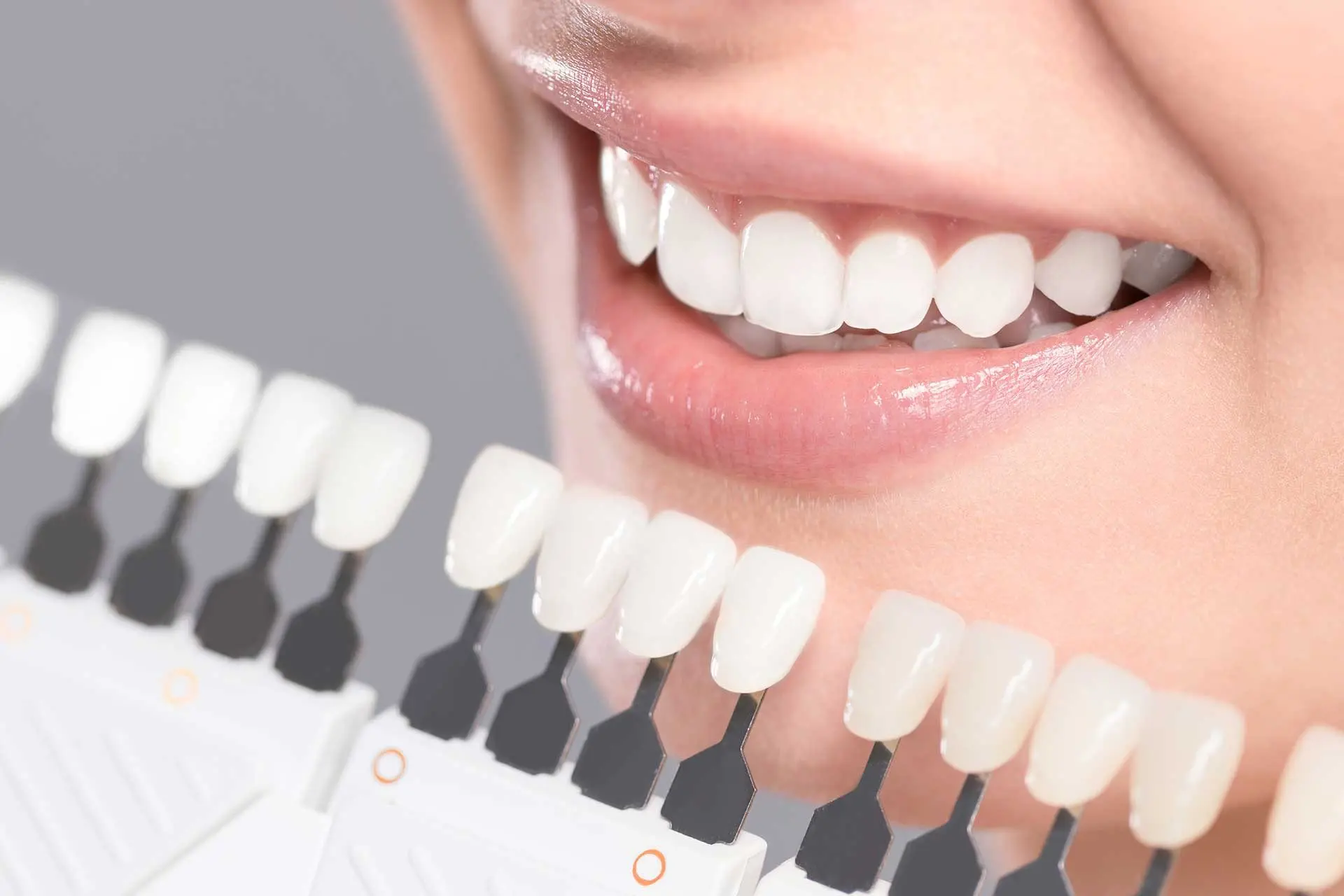 İzmir zirkonyum kaplama DentOmega