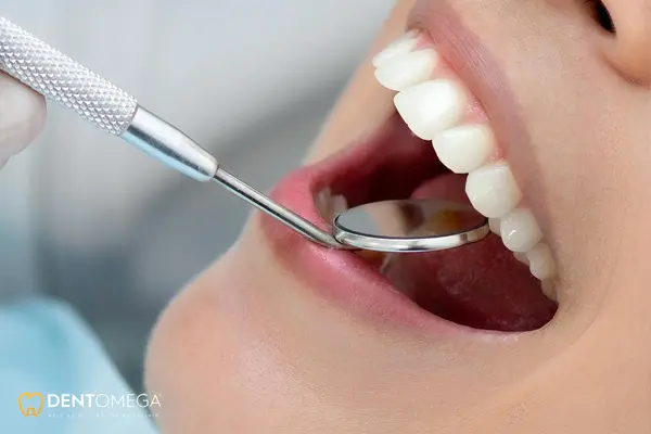 vidasız implant fiyatları